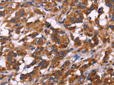 KIR2DL1/3/4/S4 Polyclonal Antibody Store at -20°C