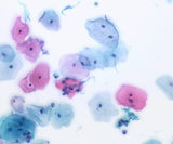 MSE PRO Trinocular Biological Microscope