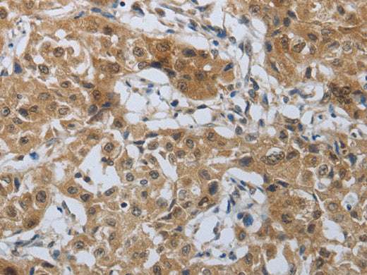 PTPRM Polyclonal Antibody Store at -20°C