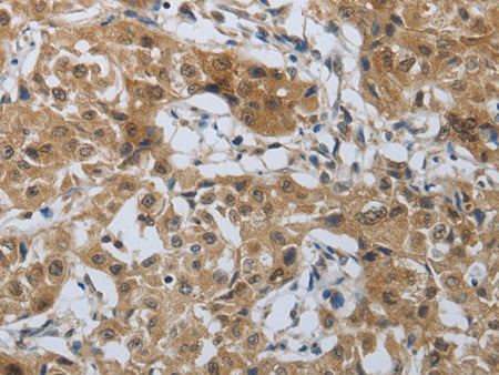 PTPRM Polyclonal Antibody Store at -20°C