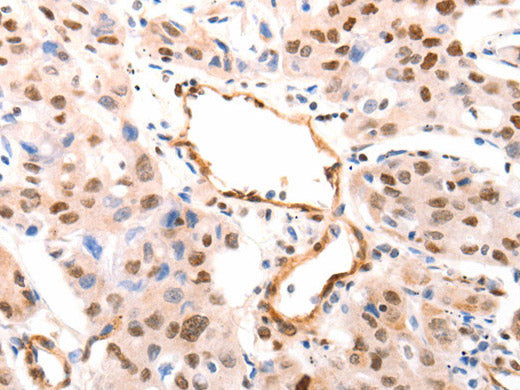 CASP9 (active) Polyclonal Antibody