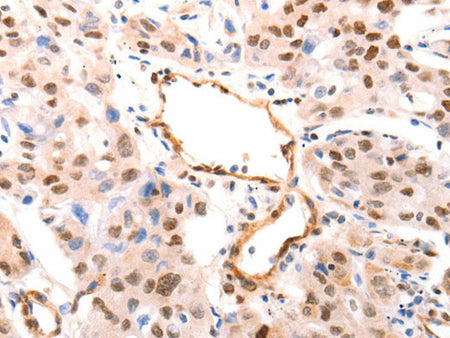 CASP9 (active) Polyclonal Antibody
