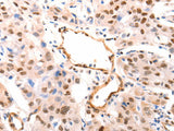 CASP9 (active) Polyclonal Antibody