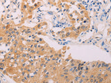 ADHFE1 Polyclonal Antibody Host Rabbit