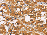 CD22 Polyclonal Antibody Store at -20°C