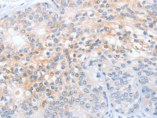 OX2R Polyclonal Antibody Store at -20°C