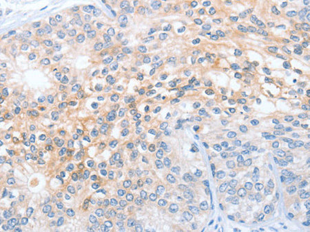 OX2R Polyclonal Antibody Store at -20°C
