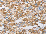 CENPO Polyclonal Antibody