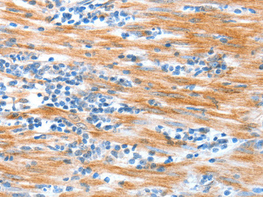 ALDOB Polyclonal Antibody Store at -20°C