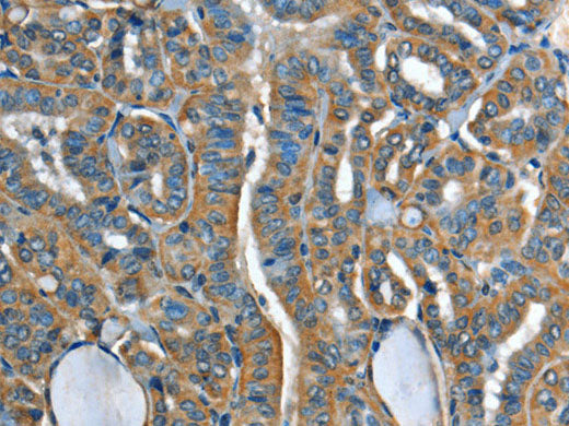 ADCY4 Polyclonal Antibody