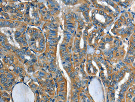 ADCY4 Polyclonal Antibody