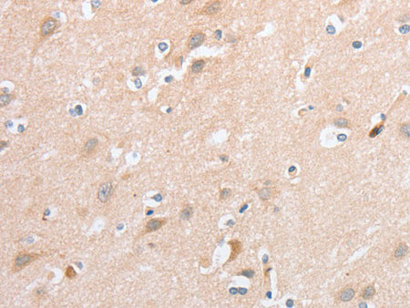 SIGLEC9 Polyclonal Antibody Store at -20°C