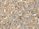 S100A4 Polyclonal Antibody Host Rabbit