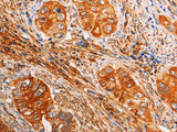 SLC25A4 Polyclonal Antibody Store at -20°C