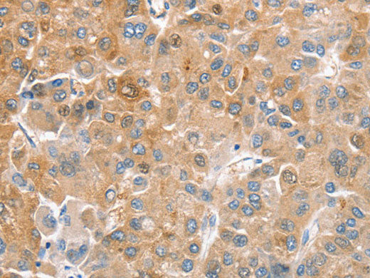 CDR2 Polyclonal Antibody