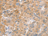 CDR2 Polyclonal Antibody