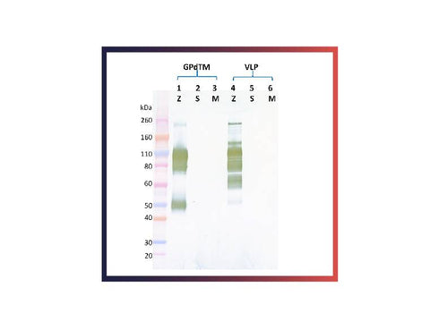 IBT Bioservices Rabbit Anti-Ebola Virus GP PAB, Biomarkers, IBT Bioservices, MSE Supplies