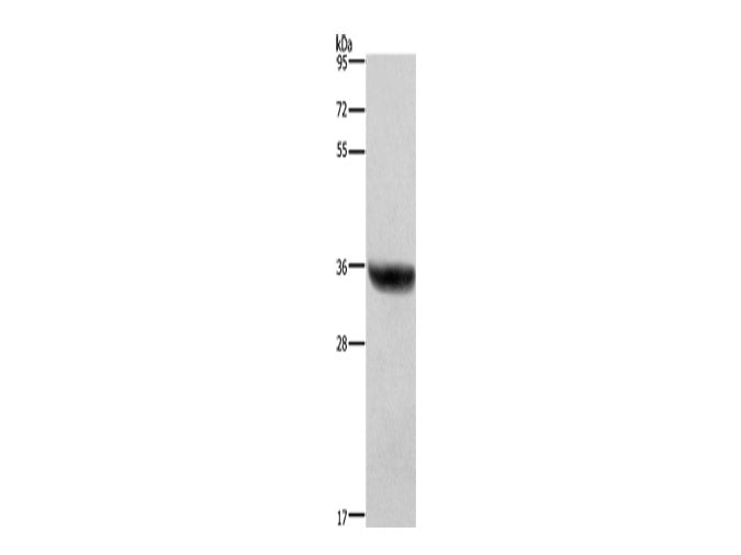 HSD17B1 Polyclonal Antibody Store at -20°C