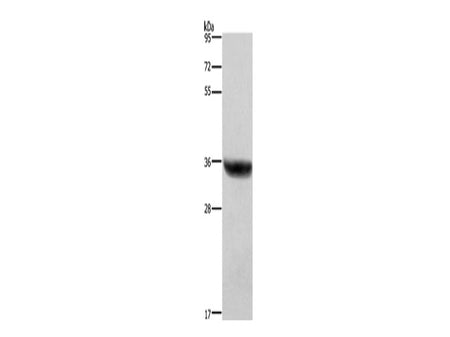 HSD17B1 Polyclonal Antibody Store at -20°C