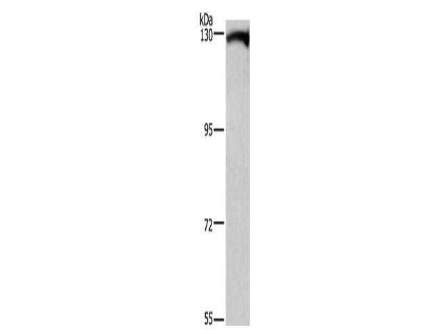 DAAM1 Polyclonal Antibody Store at -20°C