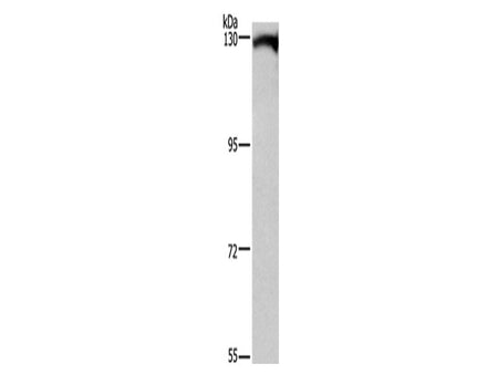 DAAM1 Polyclonal Antibody Store at -20°C