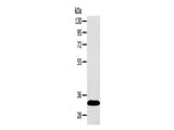 SULT2A1 Polyclonal Antibody Store at -20°C