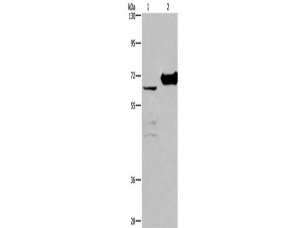 CHDH Polyclonal Antibody Store at -20°C