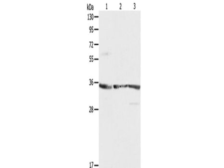 RPLP0 Polyclonal Antibody Reactivity Human, Mouse, Rat