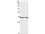RPLP0 Polyclonal Antibody Reactivity Human, Mouse, Rat