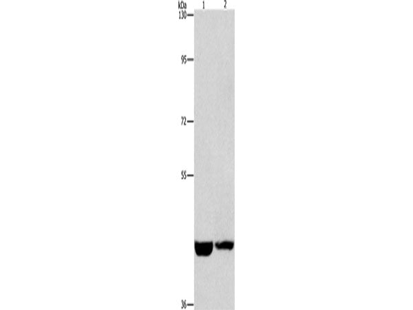 CSNK1E Polyclonal Antibody Store at -20°C