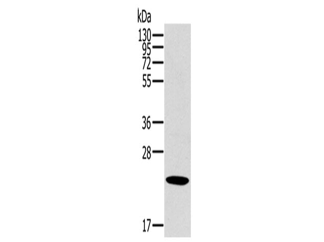 OTUB2 Polyclonal Antibody