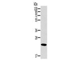 OTUB2 Polyclonal Antibody