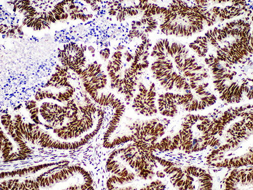 Factor XIIIa Monoclonal Antibody stored at 2~8°C