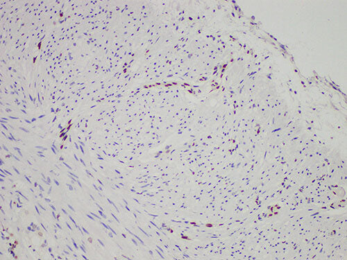 FLI1 Monoclonal Antibody stored at 2~8°C