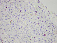 FLI1 Monoclonal Antibody stored at 2~8°C