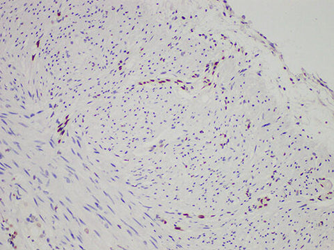 FLI1 Monoclonal Antibody stored at 2~8°C