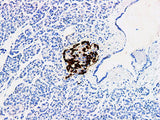 Glucagon Monoclonal Antibody stored at 2~8°C