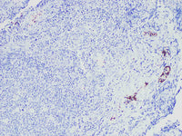 CD61 Monoclonal Antibody Synonyms CD61