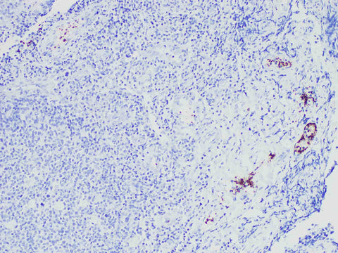 CD61 Monoclonal Antibody Synonyms CD61
