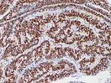 MLH1 Monoclonal Antibody Stored at 2~8°C