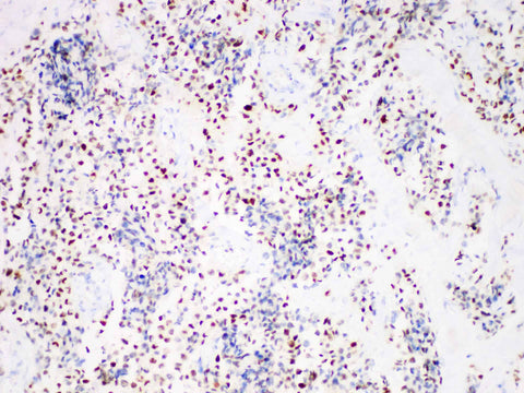 Myogenin Monoclonal Antibody Stored at 2~8°C
