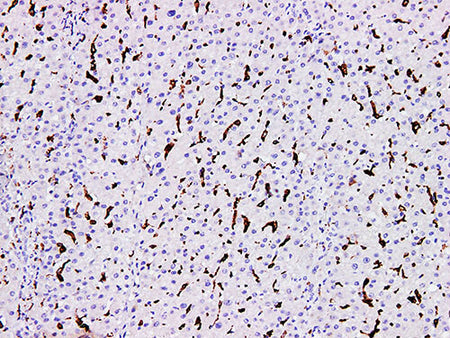CD163 Monoclonal Antibody Synonyms CD163