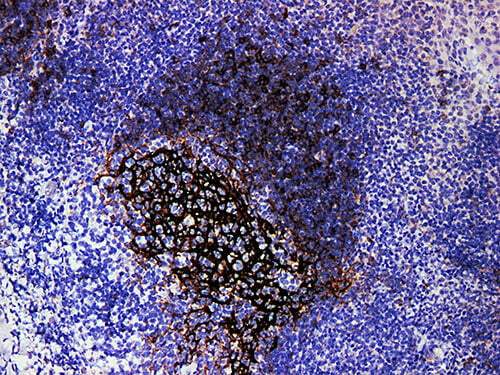 CD23 Monoclonal Antibody Synonyms CD23