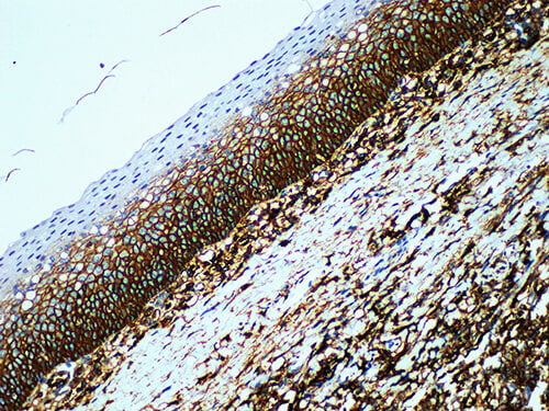 CD44 Monoclonal Antibody Synonyms CD44