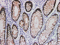 Claudin 3 Monoclonal Antibody Synonyms Claudin 3