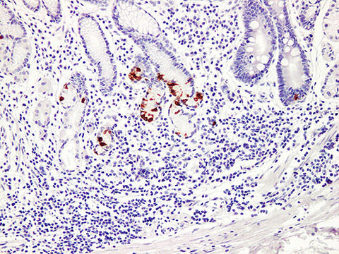 Gastrin Monoclonal Antibody stored at 2~8°C