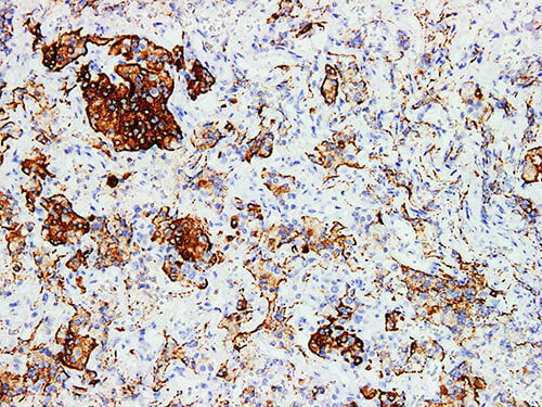 GH Monoclonal Antibody stored at 2~8°C
