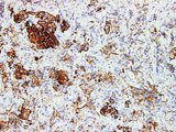 GH Monoclonal Antibody stored at 2~8°C