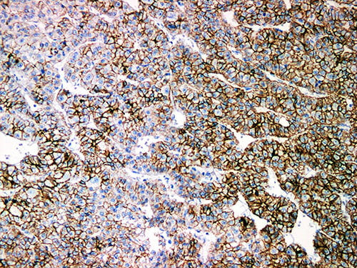 N-Cadherin Monoclonal Antibody Stored at 2~8°C