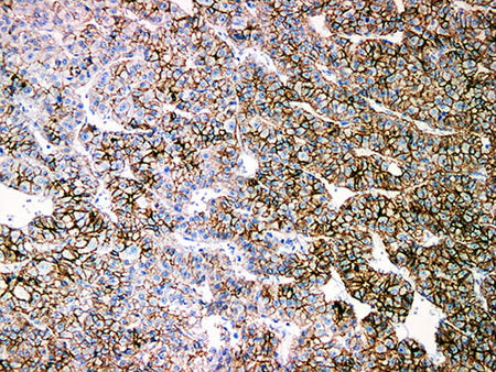 N-Cadherin Monoclonal Antibody Stored at 2~8°C